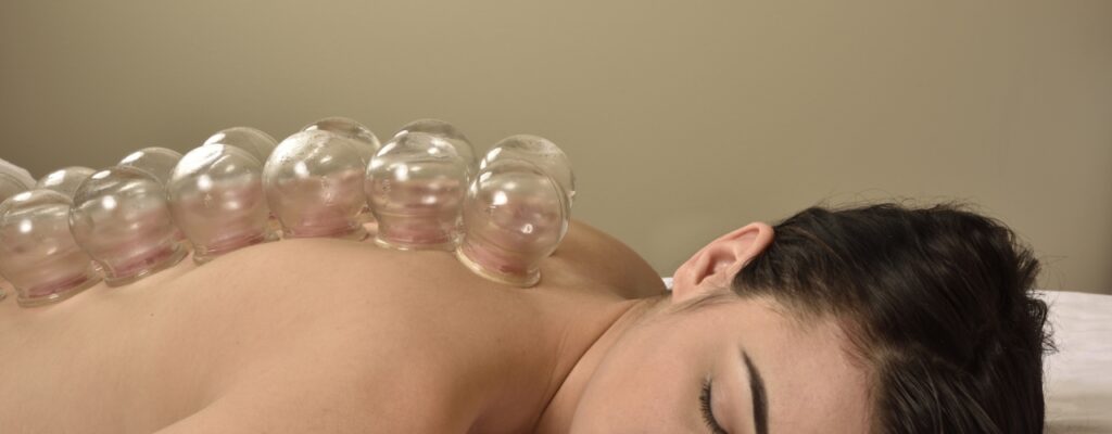 physical-therapy-clinic-cupping-sterling-physical-therapy-_-wellness-sugar-land-stafford-bellaire-tx